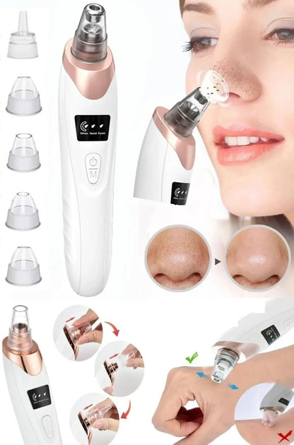 SİYAH NOKTA TEMİZLEME CİHAZI