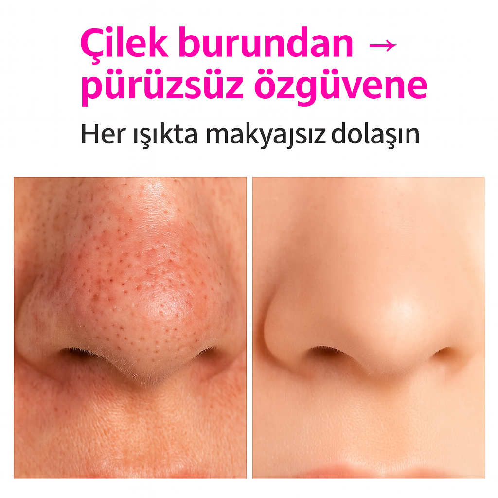 SİYAH NOKTA TEMİZLEME CİHAZI