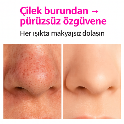 SİYAH NOKTA TEMİZLEME CİHAZI