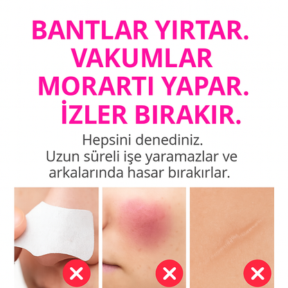 SİYAH NOKTA TEMİZLEME CİHAZI