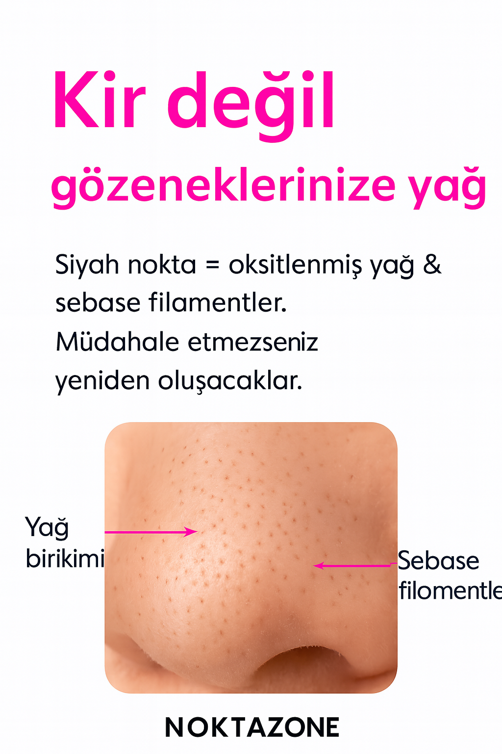 SİYAH NOKTA TEMİZLEME CİHAZI