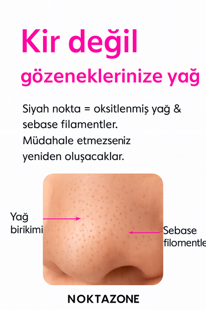 SİYAH NOKTA TEMİZLEME CİHAZI