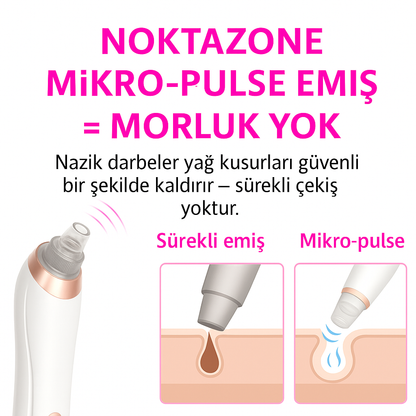 SİYAH NOKTA TEMİZLEME CİHAZI